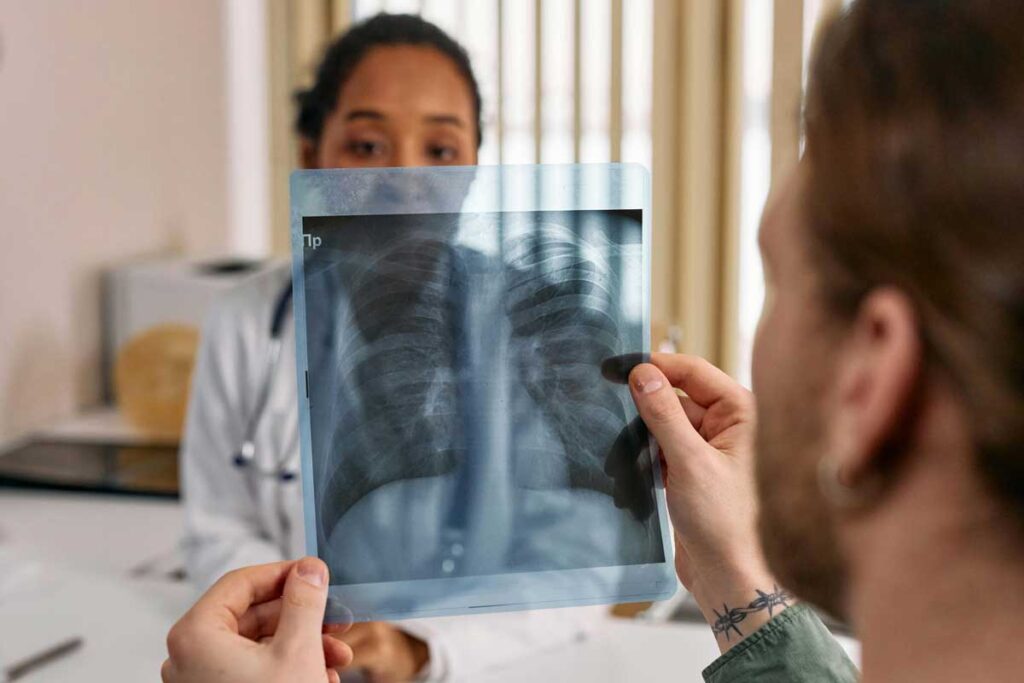 final_lungcancer1