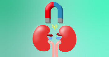 Το μαγνητικό τζελ που αφαιρεί την πέτρα στα νεφρά